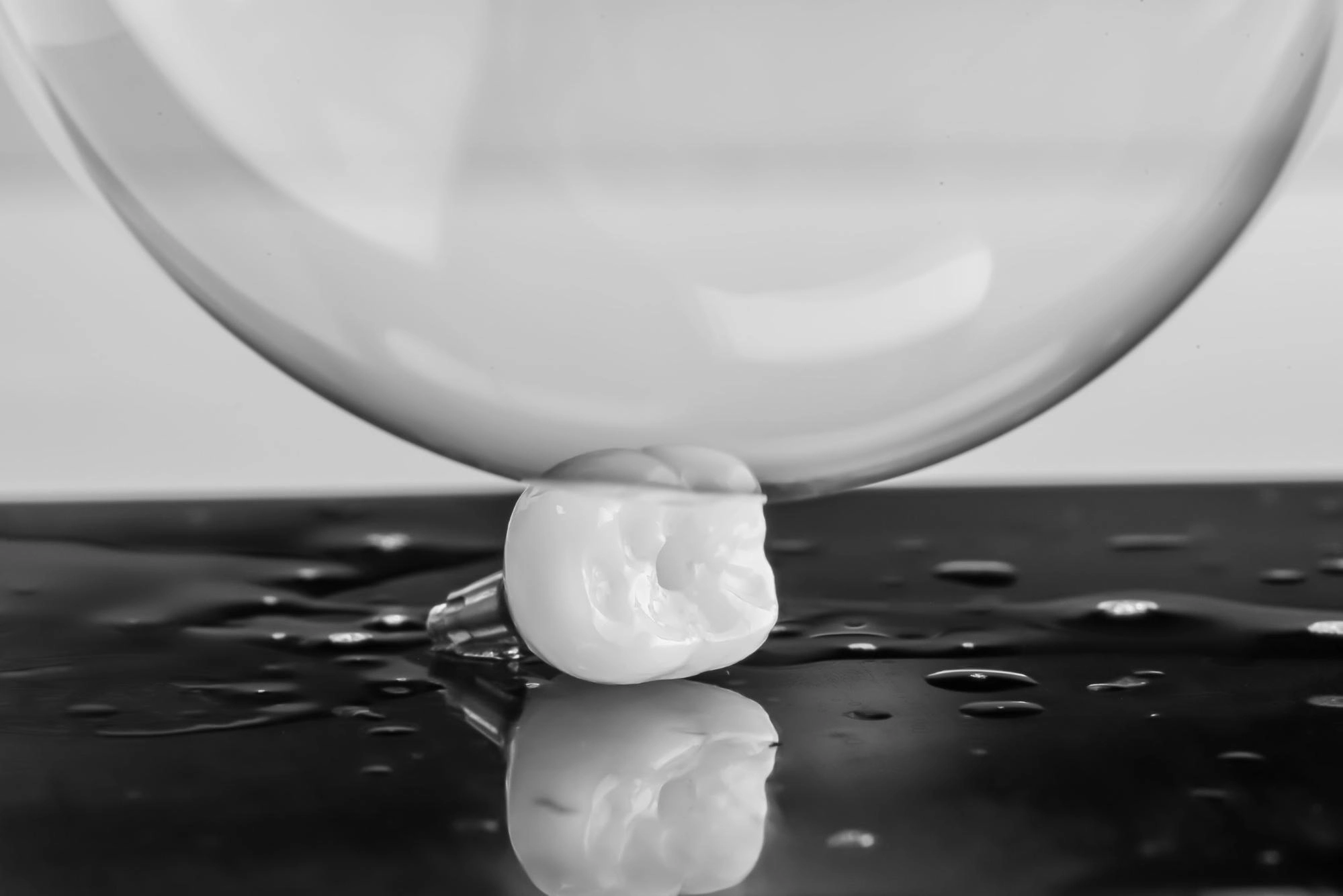 stałe implanty czasowe, stałe protezy, osadzenie całego łuku zębowego, mosty protetyczne