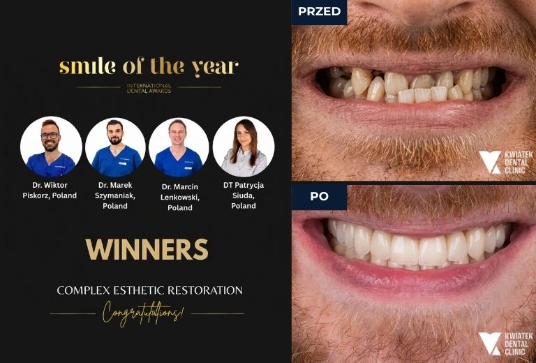 Międzynarodowy Konkurs Smile of The Year 2026 by Dental Tribune I miejsce