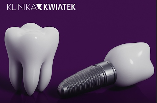 Metoda wszczepienia implantu, materiał implantu